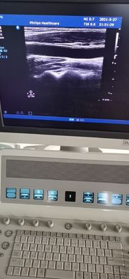 PH L12-5 Diagnóstico médico Transductor de sonda lineal ultrasónica para PH HD9 Compatible